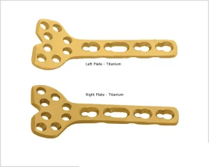 Volar Column Distal Radius Safety Lock Plate